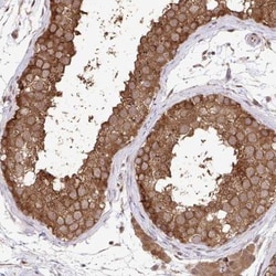 GRCC10 Antibody, Novus Biologicals 25 &mu;L, Unlabeled:Antibodies, Polyclonal