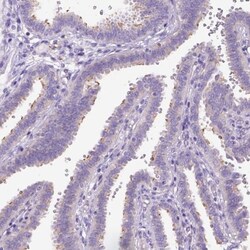 CFAP54 Antibody, Novus Biologicals 0.1mL; Unlabeled:Antibodies, Polyclonal