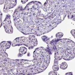 CFAP54 Antibody, Novus Biologicals 0.1mL; Unlabeled:Antibodies, Polyclonal