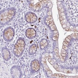 C12orf71 Antibody, Novus Biologicals 25 &mu;L, Unlabeled:Antibodies, Polyclonal
