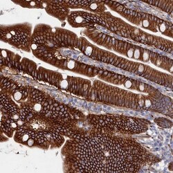 C12orf73 Antibody, Novus Biologicals:Antibodies:Primary Antibodies