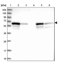 DGLUCY Antibody, Novus Biologicals 25 &mu;L; Unlabeled:Antibodies, Polyclonal