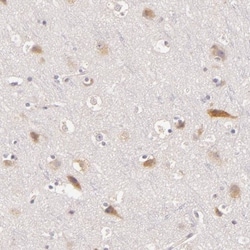 Chondroitin sulfate synthase 3 Antibody, Novus Biologicals:Antibodies:Primary