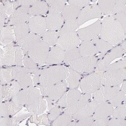 Chondroitin sulfate synthase 3 Antibody, Novus Biologicals:Antibodies:Primary