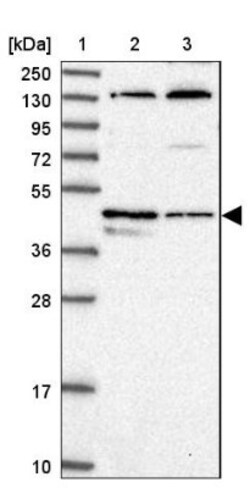 TEDC1 Antibody, Novus Biologicals:Antibodies:Primary Antibodies