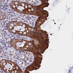 VPS35L Antibody, Novus Biologicals:Antibodies:Primary Antibodies
