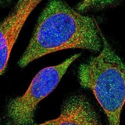 VPS9D1 Antibody, Novus Biologicals 25 &mu;L; Unlabeled:Antibodies, Polyclonal