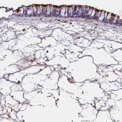 CCDC189 Antibody, Novus Biologicals 0.1mL; Unlabeled:Antibodies, Polyclonal