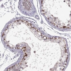 Meiosis 1 Associated Protein Antibody, Novus Biologicals 0.1mL; Unlabeled:Antibodies,