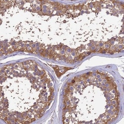 GID4 Antibody, Novus Biologicals:Antibodies:Primary Antibodies