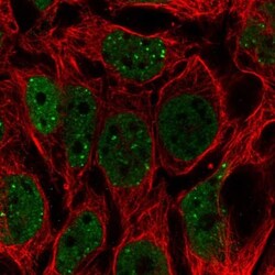 LINC02693 Antibody, Novus Biologicals:Antibodies:Primary Antibodies
