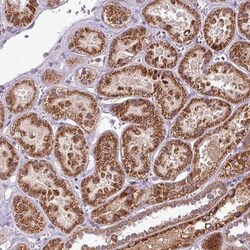 LINC02693 Antibody, Novus Biologicals:Antibodies:Primary Antibodies