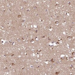 LINC02693 Antibody, Novus Biologicals:Antibodies:Primary Antibodies