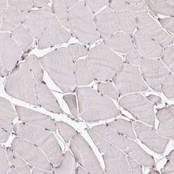 LINC02693 Antibody, Novus Biologicals:Antibodies:Primary Antibodies