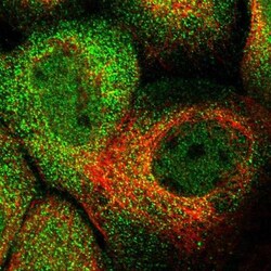 HROB Antibody, Novus Biologicals:Antibodies:Primary Antibodies