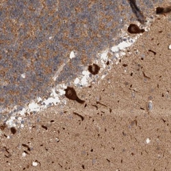 HROB Antibody, Novus Biologicals:Antibodies:Primary Antibodies