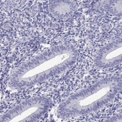 PKN1 Antibody, Novus Biologicals:Antibodies:Primary Antibodies