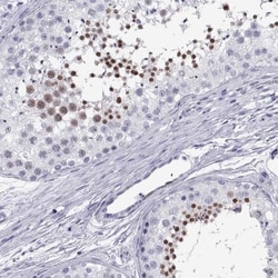 PKN1 Antibody, Novus Biologicals:Antibodies:Primary Antibodies