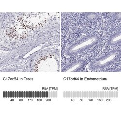 PKN1 Antibody, Novus Biologicals:Antibodies:Primary Antibodies
