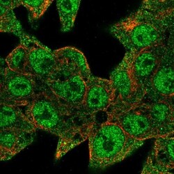 EPOP Antibody, Novus Biologicals 0.1mL; Unlabeled:Antibodies, Polyclonal