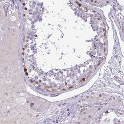 EPOP Antibody, Novus Biologicals 0.1mL; Unlabeled:Antibodies, Polyclonal