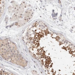 LIAT1 Antibody, Novus Biologicals 0.1mL; Unlabeled:Antibodies, Polyclonal