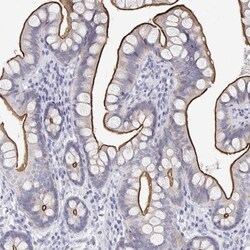 MISP1 Antibody, Novus Biologicals:Antibodies:Primary Antibodies