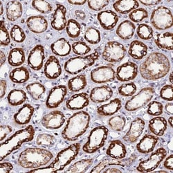 C19orf24 Antibody, Novus Biologicals 0.1mL; Unlabeled:Antibodies, Polyclonal
