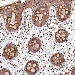 SMIM7 Antibody, Novus Biologicals:Antibodies:Primary Antibodies
