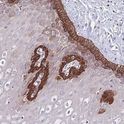 C19orf57 Antibody, Novus Biologicals 0.1mL; Unlabeled:Antibodies, Polyclonal