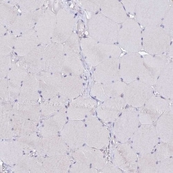 C19orf57 Antibody, Novus Biologicals 0.1mL; Unlabeled:Antibodies, Polyclonal