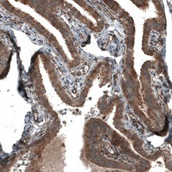 RyDEN Antibody, Novus Biologicals:Antibodies:Primary Antibodies