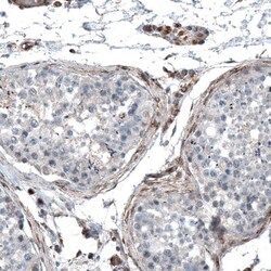 RyDEN Antibody, Novus Biologicals:Antibodies:Primary Antibodies