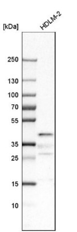 RyDEN Antibody, Novus Biologicals:Antibodies:Primary Antibodies