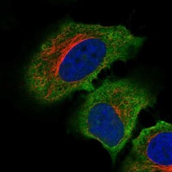 C19orf71 Antibody, Novus Biologicals 0.1mL; Unlabeled:Antibodies, Polyclonal