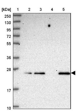 C19orf71 Antibody, Novus Biologicals 0.1mL; Unlabeled:Antibodies, Polyclonal
