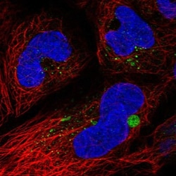 C19orf81 Antibody, Novus Biologicals:Antibodies:Primary Antibodies