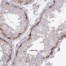 C19orf81 Antibody, Novus Biologicals:Antibodies:Primary Antibodies