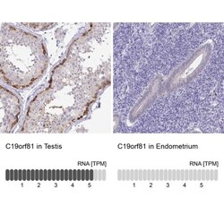 C19orf81 Antibody, Novus Biologicals:Antibodies:Primary Antibodies
