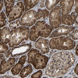 C1GALT1 Antibody, Novus Biologicals 0.1mL; Unlabeled:Antibodies, Polyclonal