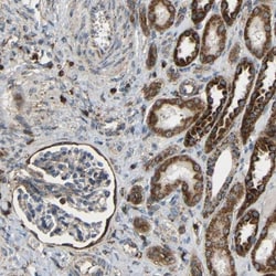 C1GALT1 Antibody, Novus Biologicals:Antibodies:Primary Antibodies