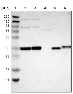 C1GALT1 Antibody, Novus Biologicals:Antibodies:Primary Antibodies