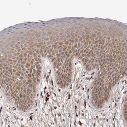 INAVA Antibody, Novus Biologicals 0.1mL; Unlabeled:Antibodies, Polyclonal