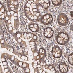 INAVA Antibody, Novus Biologicals 0.1mL; Unlabeled:Antibodies, Polyclonal