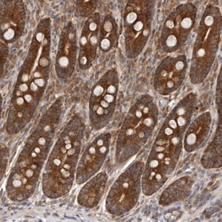 C1orf109 Antibody, Novus Biologicals:Antibodies:Primary Antibodies