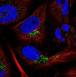 CCDC190 Antibody, Novus Biologicals 0.1mL; Unlabeled:Antibodies, Polyclonal