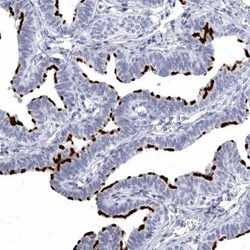 CCDC181 Antibody, Novus Biologicals:Antibodies:Primary Antibodies