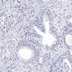 CCDC181 Antibody, Novus Biologicals:Antibodies:Primary Antibodies