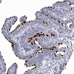 CCDC181 Antibody, Novus Biologicals:Antibodies:Primary Antibodies
