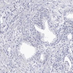 CCDC181 Antibody, Novus Biologicals:Antibodies:Primary Antibodies